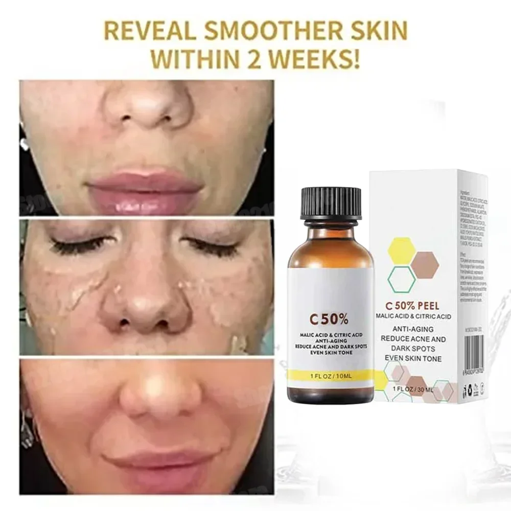 Kwas Salicylowy Peeling do Twa – Tranexamic Acid Serum recenzja i cena