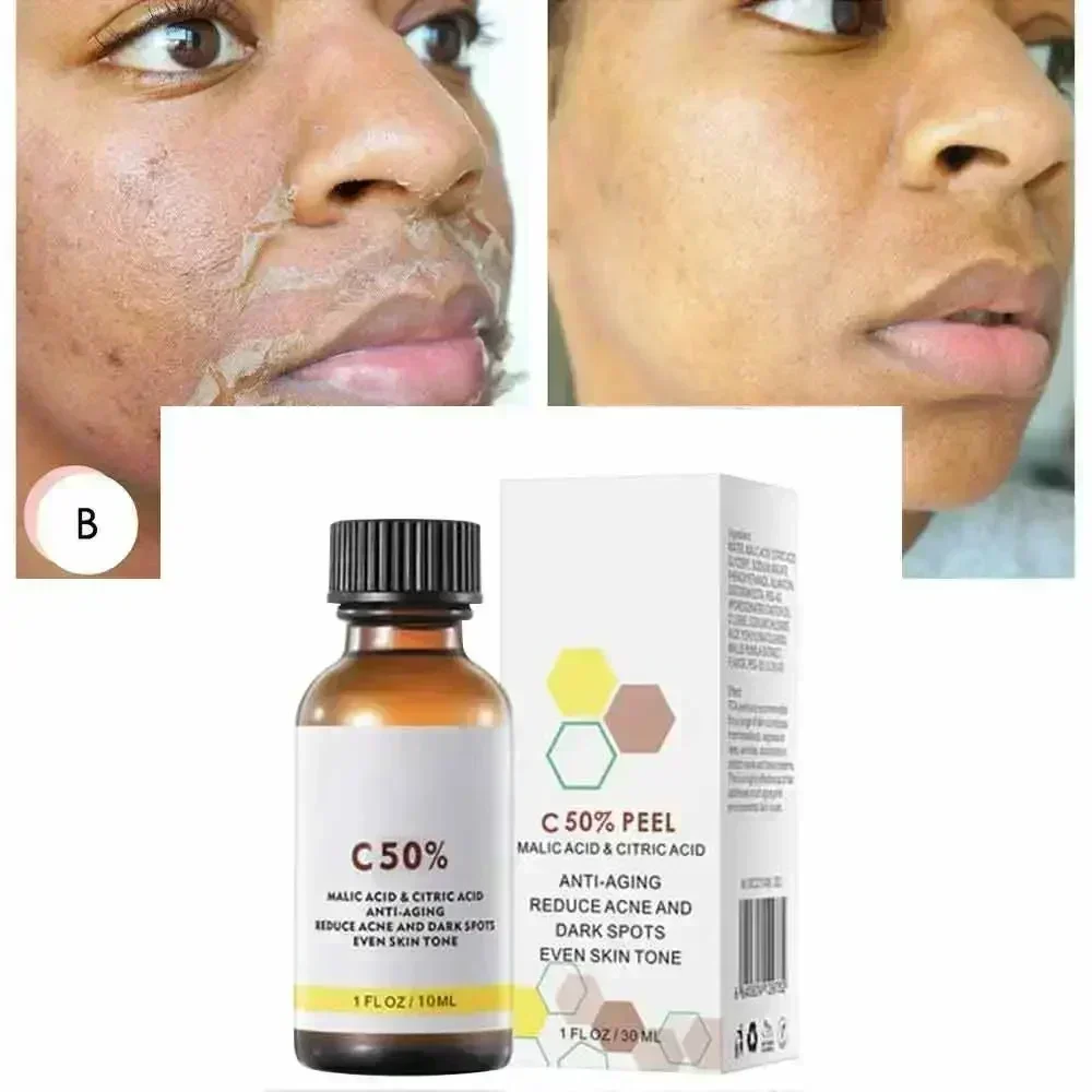 Kwas Salicylowy Peeling do Twa – Tranexamic Acid Serum recenzja i cena