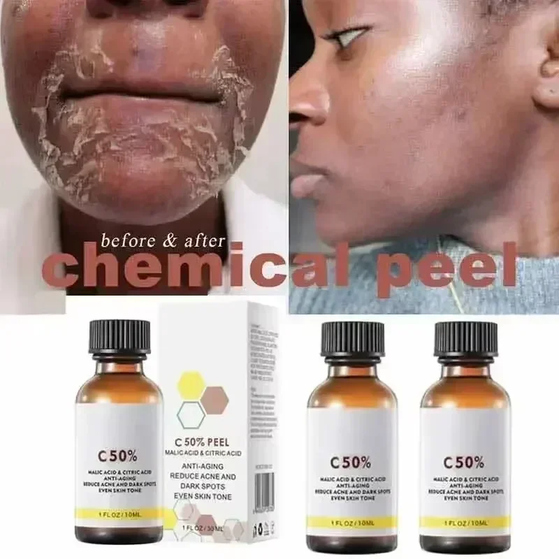 Kwas Salicylowy Peeling do Twa – Tranexamic Acid Serum recenzja i cena
