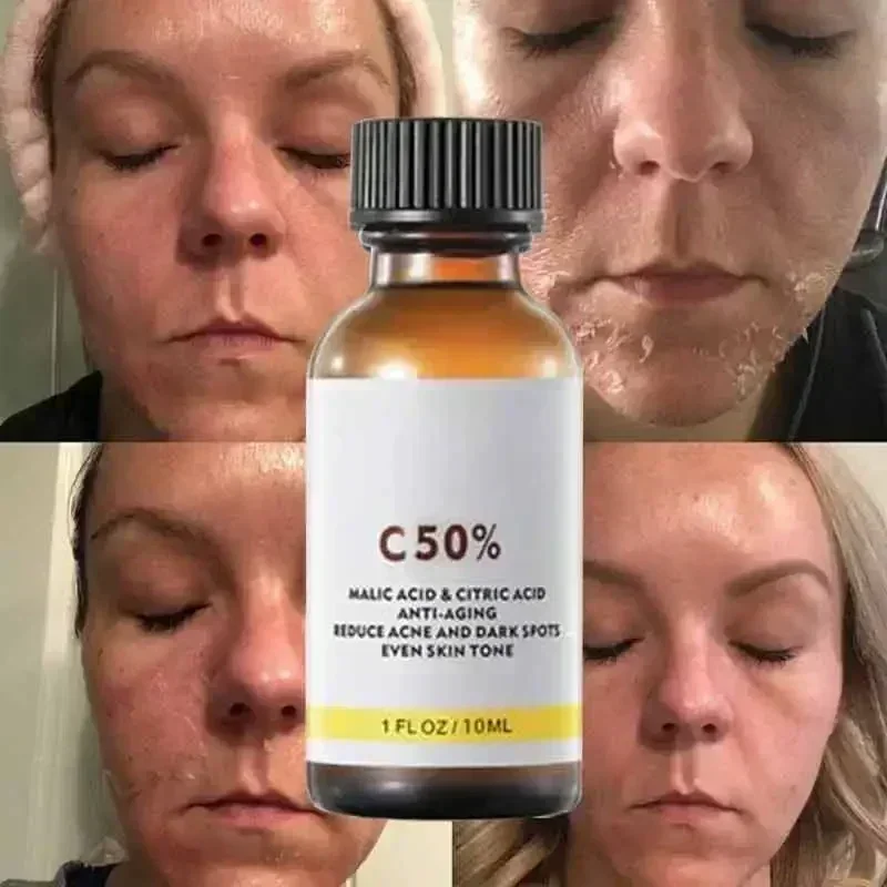 Kwas Salicylowy Peeling do Twa – Tranexamic Acid Serum recenzja i cena