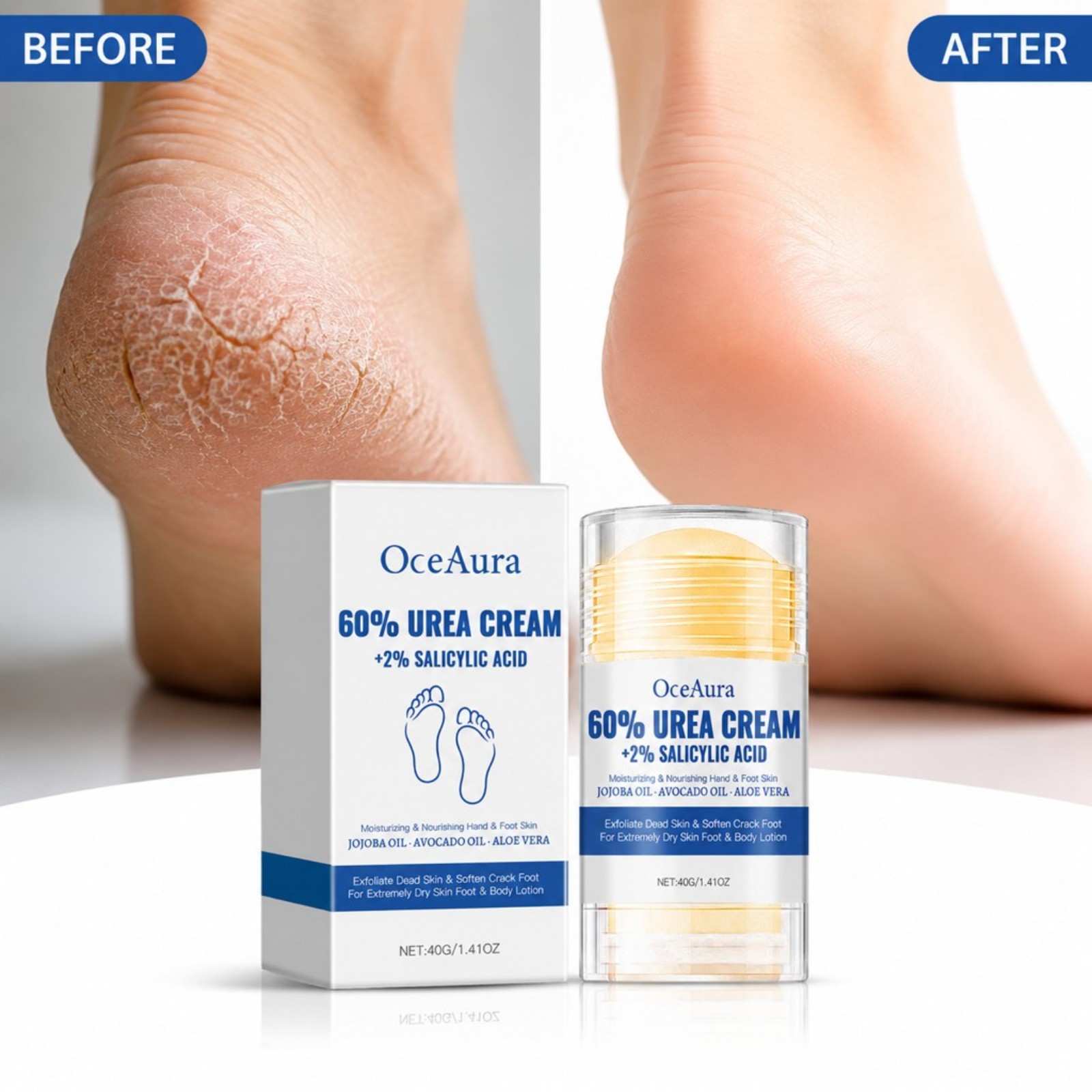 Krem do stóp w sztyfcie z 60%  – Urea Foot Cream recenzja i cena