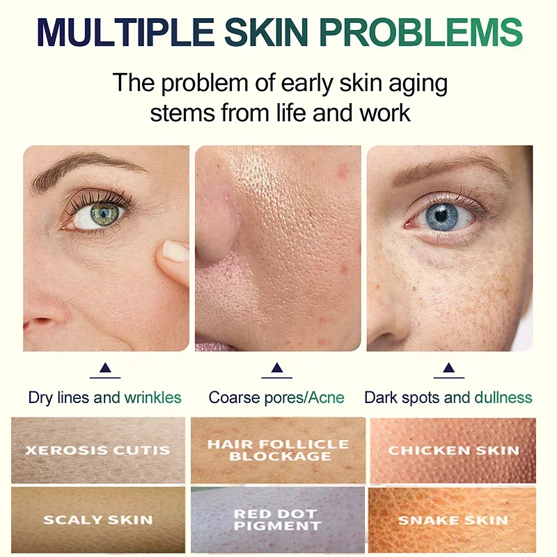 2. Generacja Serum Peelingując – Tranexamic Acid Serum recenzja i cena