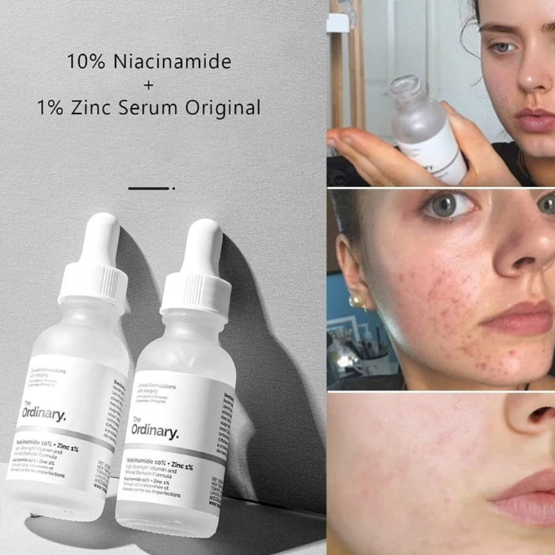 The Ordinary Niacinamide 10% + – Skincare La Roche Posay recenzja i cena