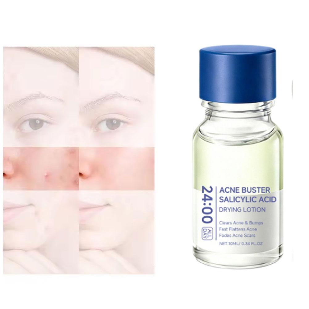 Esencja z kwasem salicylowym,  – Tranexamic Acid Serum recenzja i cena