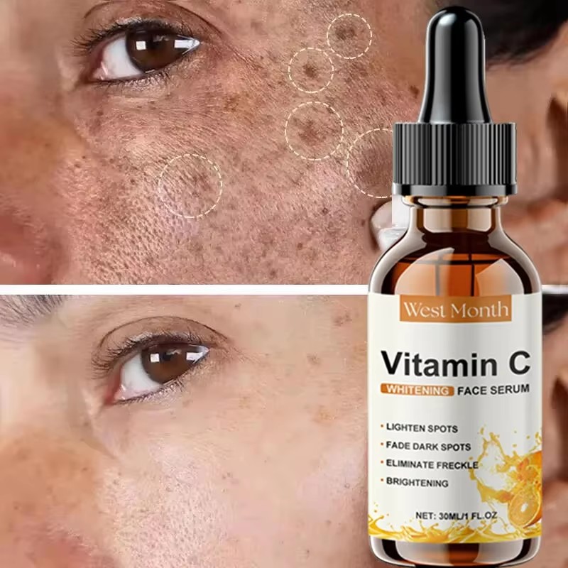 Serum z Witaminą C Rozjaśniają – Skincare La Roche Posay recenzja i cena