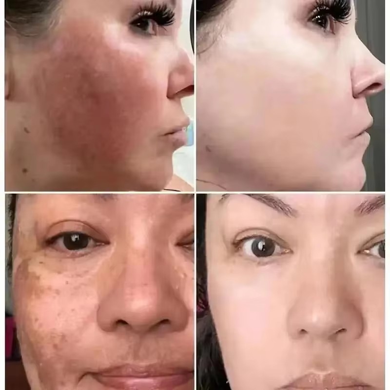 Serum z Witaminą C Rozjaśniają – Skincare La Roche Posay recenzja i cena