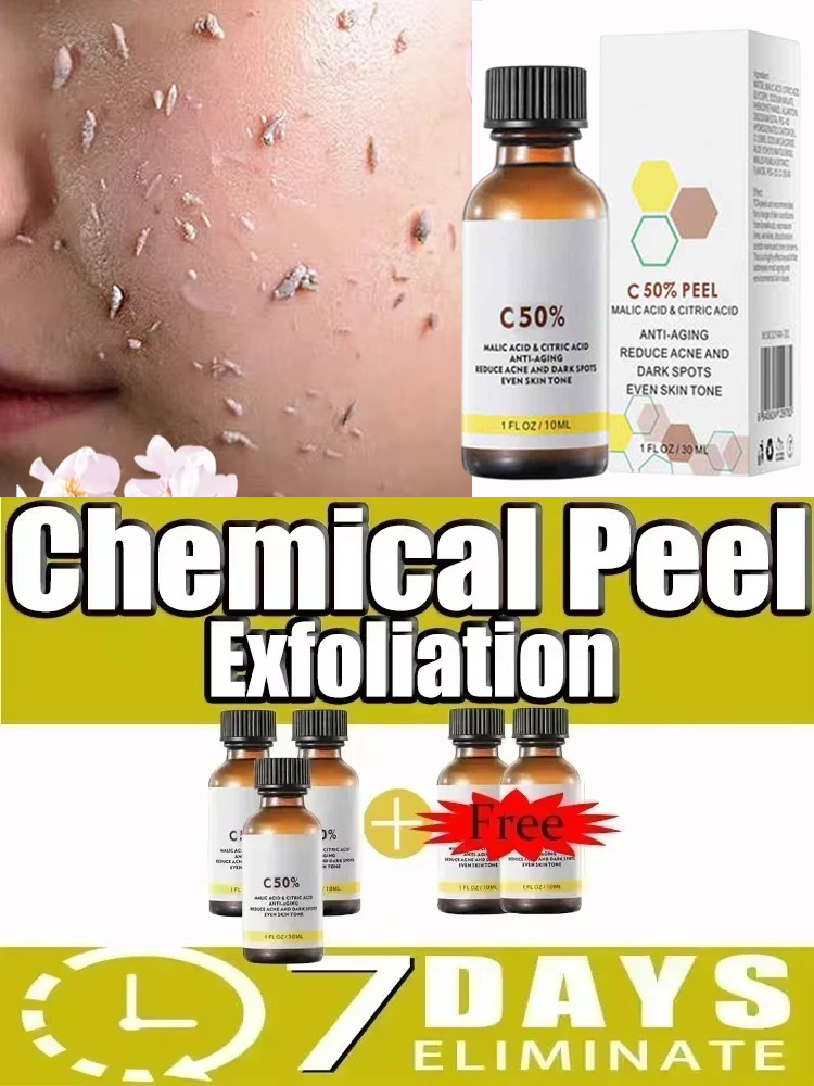 Olejek do peelingu nr 3 na prz – Tranexamic Acid Serum recenzja i cena